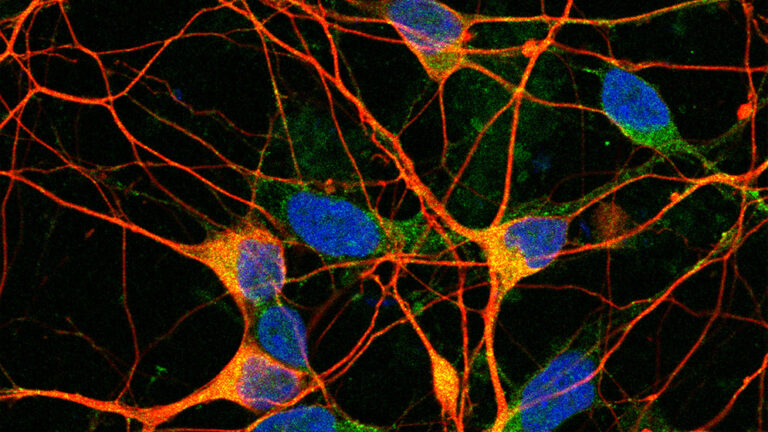 Reciben apoyo a su búsqueda de terapias contra el Alzheimer